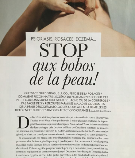 Psoriasis, Rosacée et Eczéma